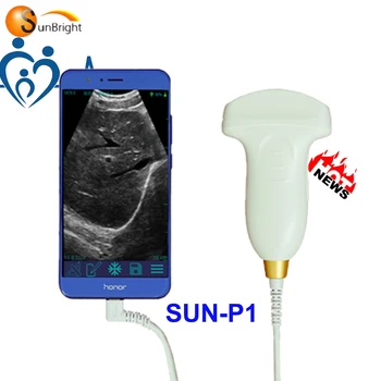 Çin Popüler kablosuz taşınabilir ultrason usb probu cep telefonu ultrason tarayıcı